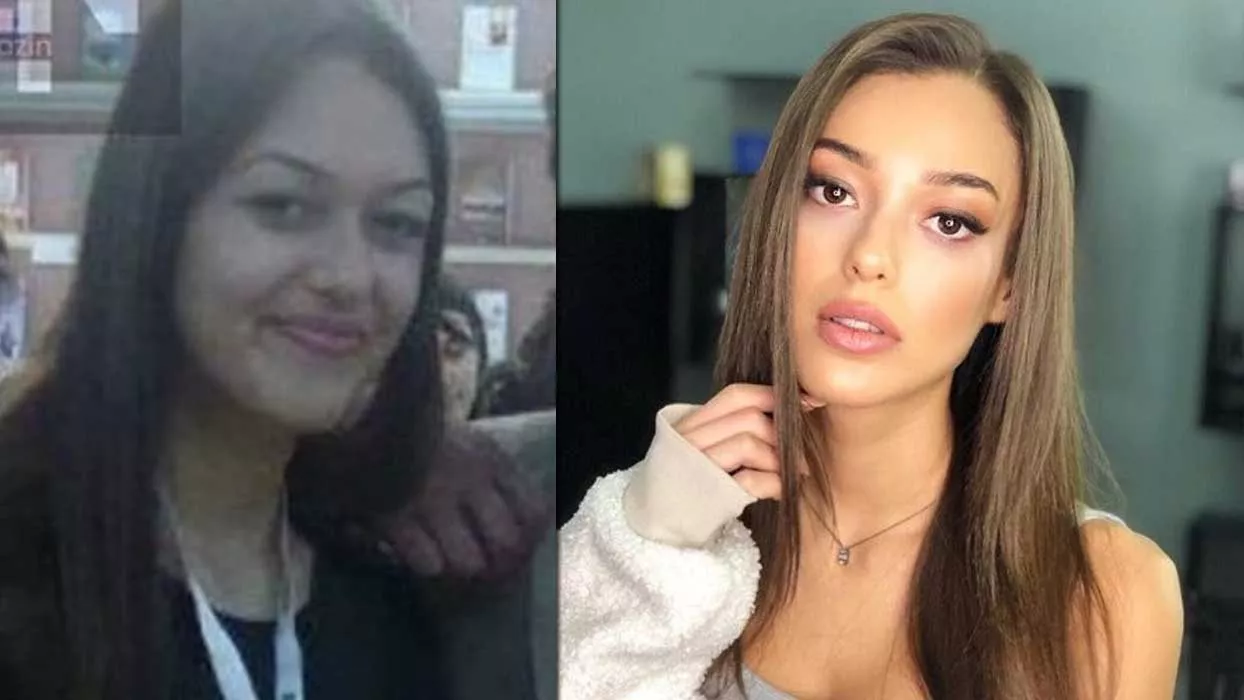 Dilan Çiçek Deniz'in estetiksiz hali gündem oldu: İşte o fotoğraflar... 7