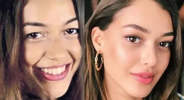 Dilan Çiçek Deniz'in estetiksiz hali gündem oldu: İşte o fotoğraflar... 6