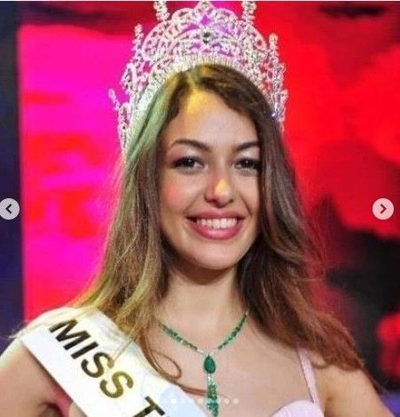 Dilan Çiçek Deniz'in estetiksiz hali gündem oldu: İşte o fotoğraflar... 8
