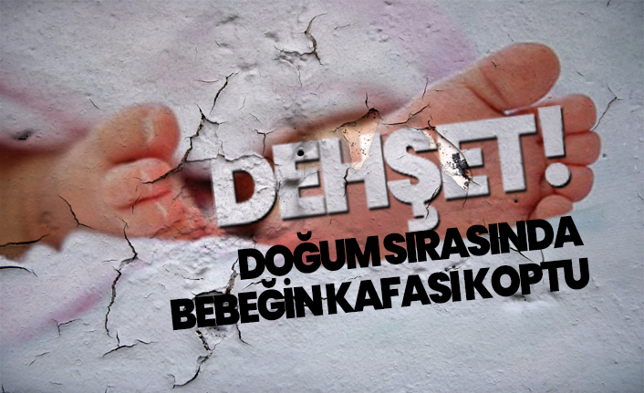 DEHŞET! Doğum sırasında  Bebeğin kafası koptu