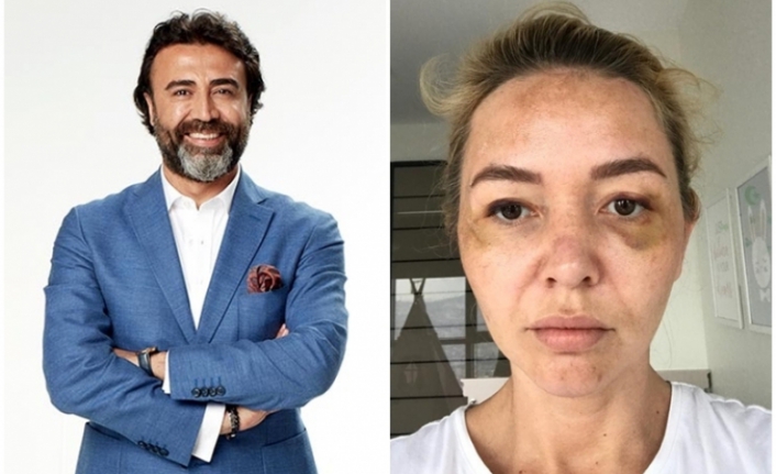 Dr. Nihat Dik'den dayak iddiaları hakkında açıklama