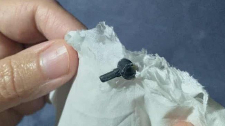 Doktorların bulamadığı Lego parçası, 2 sene sonra düştü