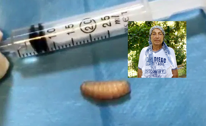 Sinüslerinden 11 kurtçuk çıktı