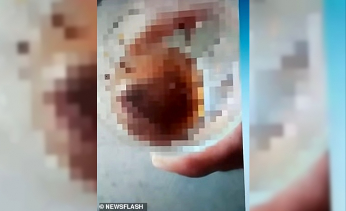 Kendisine tecavüz etmeye kalkan eski sevgilisinin cinsel organını ısırarak kopardı