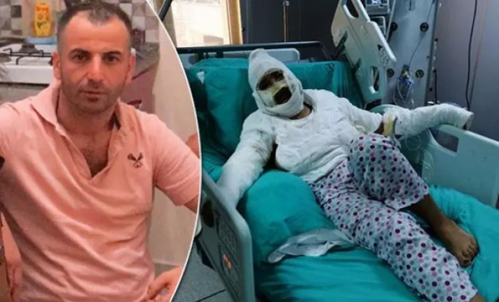 Yüzüne kızgın yağ döken erkek arkadaşı ceza alınca ağladı: "Bu kararı kabul etmiyorum, bırakın onu"