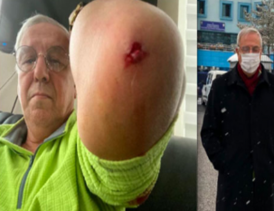 Orhan Uğuroğlu'na saldıranlar serbest bırakıldı