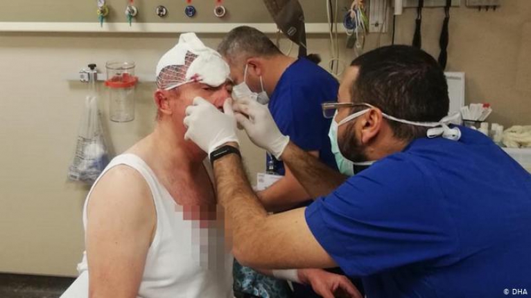 Selçuk Özdağ’a saldıran 3 kişi hakkında yakalama kararı!