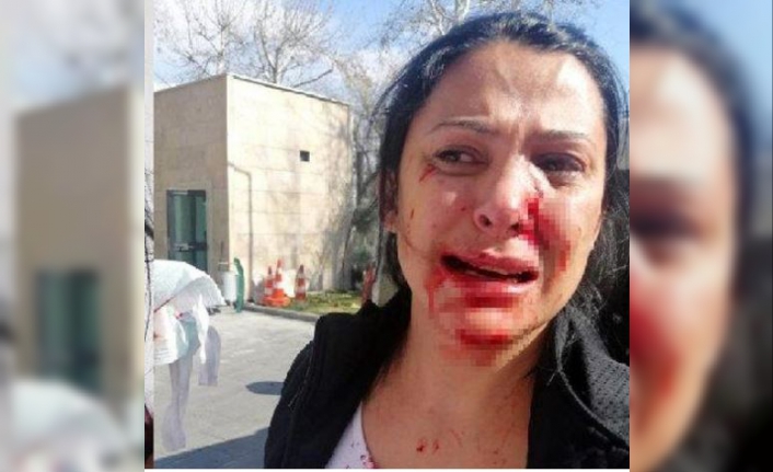 Öğretmen dehşet saçtı: Kalemi yüzüne sapladı