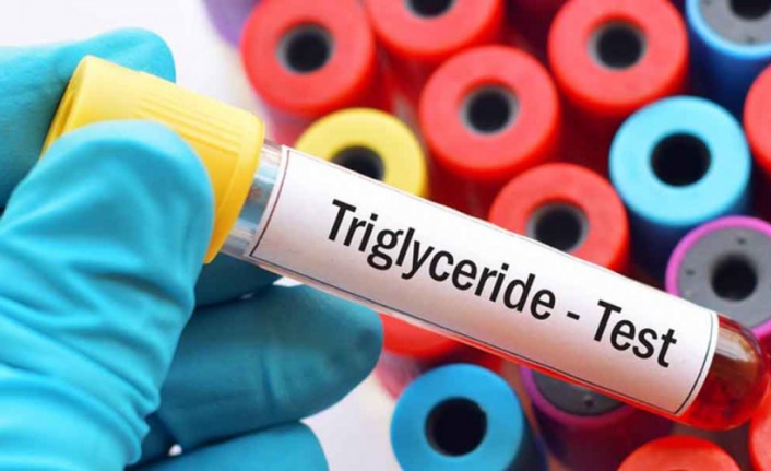 Trigliserid nedir
