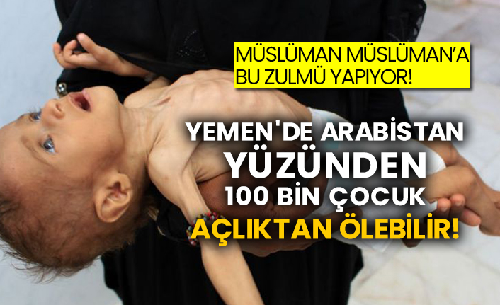 Yemen'de Arabistan yüzünden 100 bin çocuk açlıktan ölebilir!