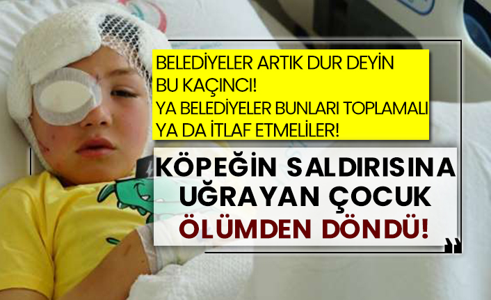 Belediyeler artık dur deyin bu kaçıncı!  Ya belediyeler bunları toplamalı ya da itlaf etmeliler!  Köpeğin saldırısına uğrayan çocuk ölümden döndü!