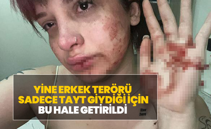 Suçu Sadece  Tayt Giymek