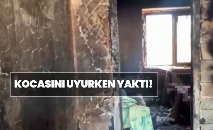 Kocasını uyurken yaktı