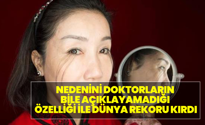 Yüzünü gören bir daha dönüp bakıyor!