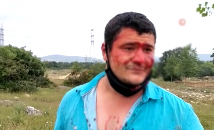 Lütfü Türkkan'ın adamlarının saldırdığı İHA muhabiri olayında önemli gelişme!