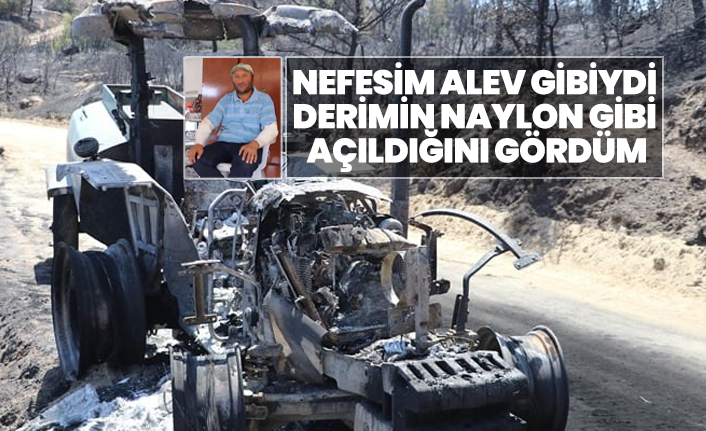 Yangından kaçarak kurtulan çiftçi anlattı "Nefesim alev gibiydi, derimin naylon gibi açıldığını gördüm"