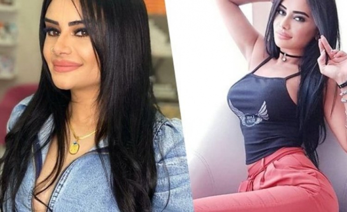 Kalça estetiği yaptıran Naz Mila'dan cesur paylaşım