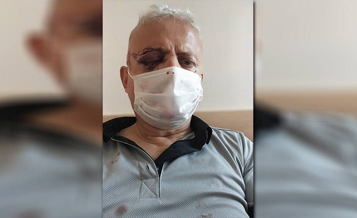 İstanbul'da metrobüste güvenlik görevlisine maske saldırısı!