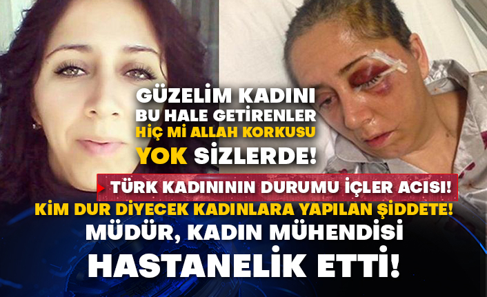 Türk kadınının durumu içler acısı! Kim dur diyecek kadınlara şiddete! Müdür, kadın mühendisi hastanelik etti!