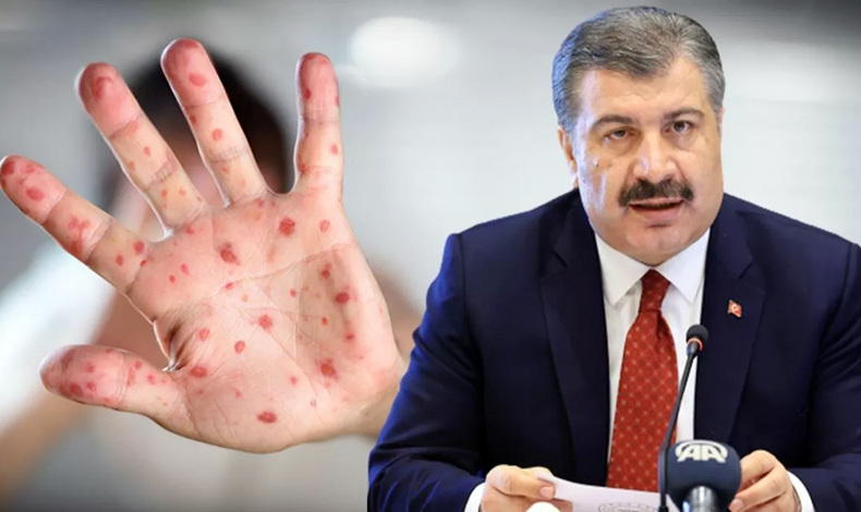 MAYMUN ÇİÇEĞİ VİRÜSÜ TÜRKİYE'YE SIÇRADI
