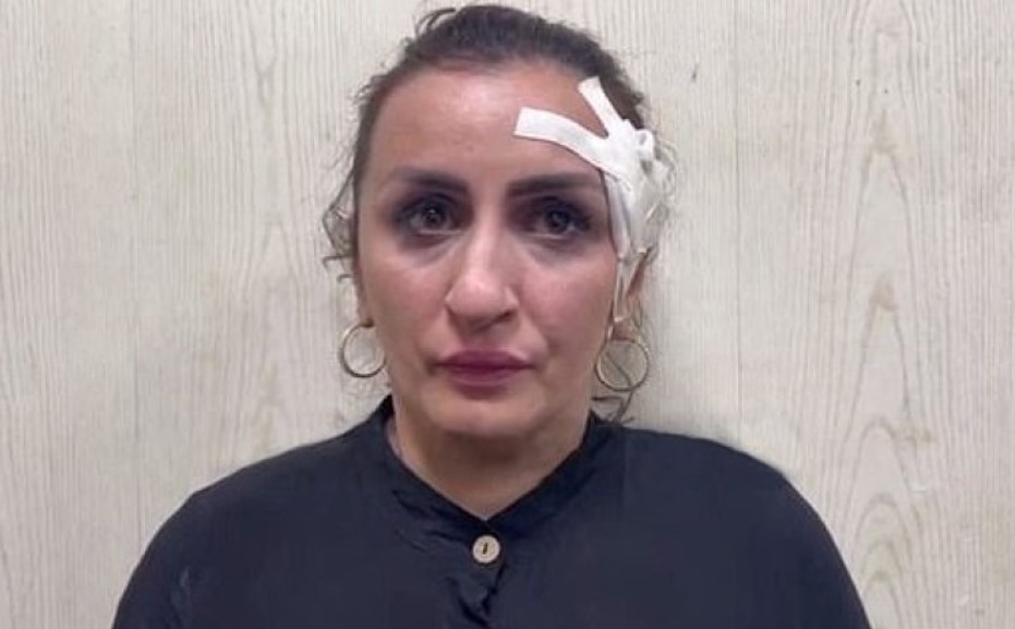 BURUNUNU YAPTIRMAK İÇİN 5 GÜNLÜK BEBEĞİNİ SATAN KADIN TUTUKLANDI!