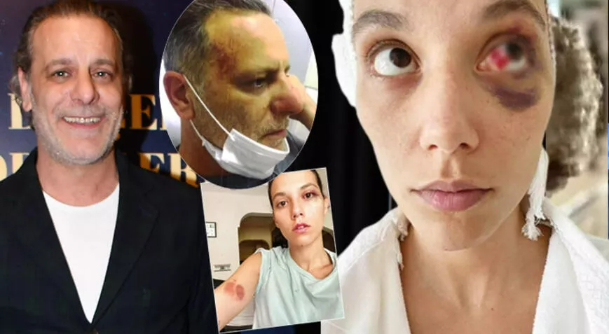 Ozan Güven: Photoshop olduğu ortaya çıkacak