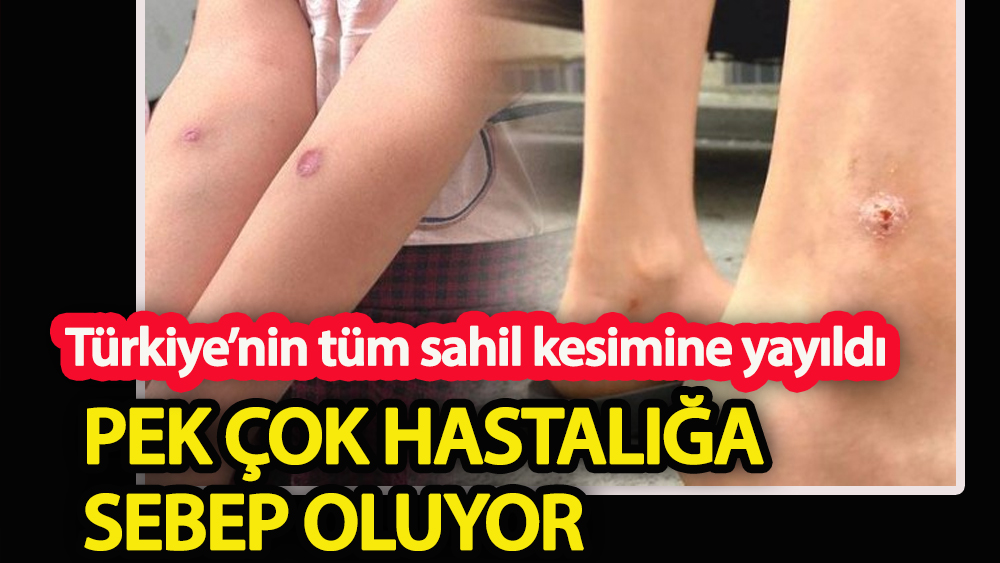 Türkiye’nin tüm sahil kesimine yayıldı