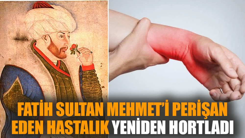 Fatih Sultan Mehmet’i perişan eden hastalık yeniden hortladı
