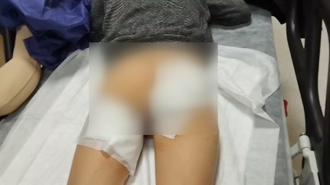 Köpeklerinin saldırısına uğrayan 7 yaşındaki Çağrı'ya 30 dikiş atıldı