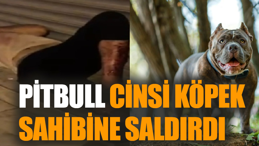 Pitbull Köpek Saldırısı Kamerada: Ailesinden 3 Kişiyi Isırdı