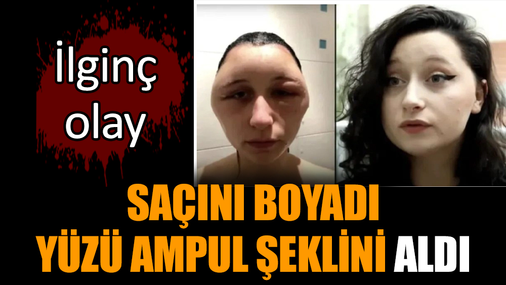 Saçını boyadı, yüzü ampul şeklini aldı