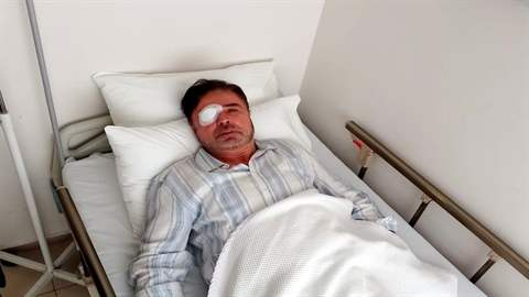 Gözlükten kurtulmak isterken kör oldu