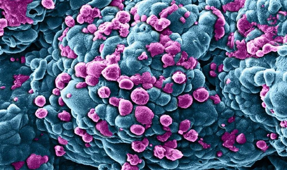 Nobel Ödüllü Bilim İnsanı, Kanserin Temel Nedenini Açıkladı