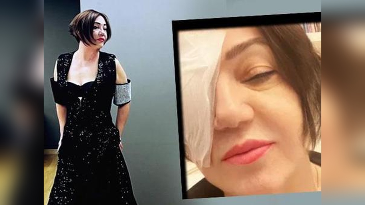 Nazan Öncel, Göz Ameliyatı Geçirdiğini Duyurdu