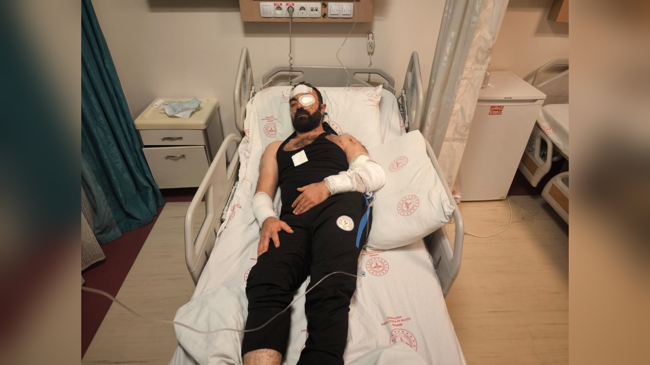 Dernek Başkanı Silahlı Kavga Sonrası Yaralandı