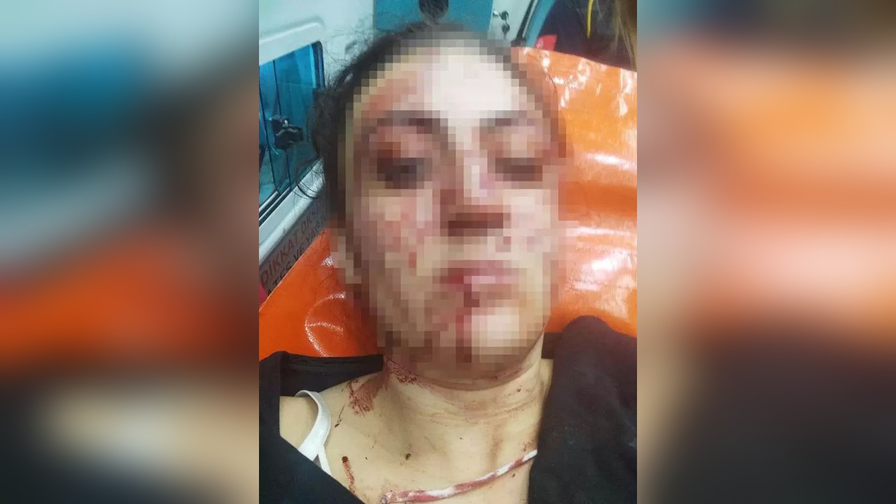 Eski Eşin Bıçaklama Olayında Cezası Belirlenecek