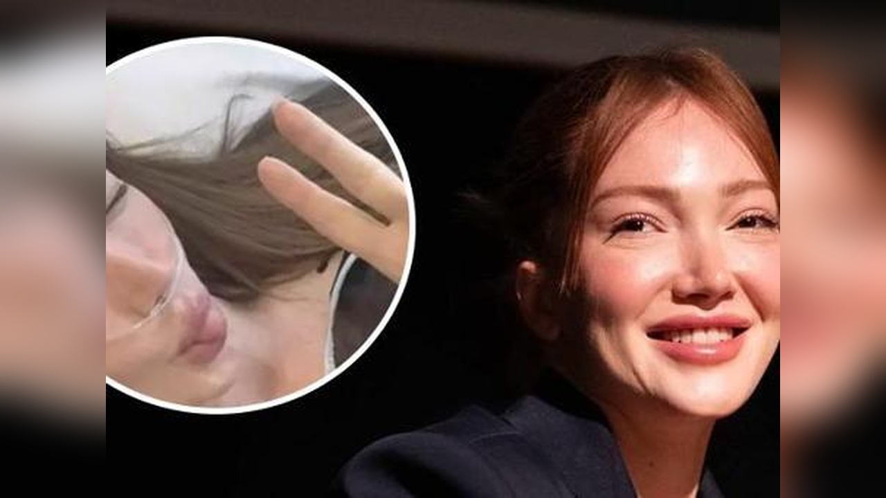 Danla Bilic, Estetik Operasyonunu Açıkladı