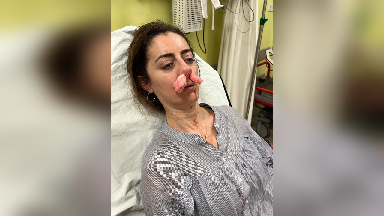 Eşinin Sevgilisi Zannedilen Kadın Darbedildi