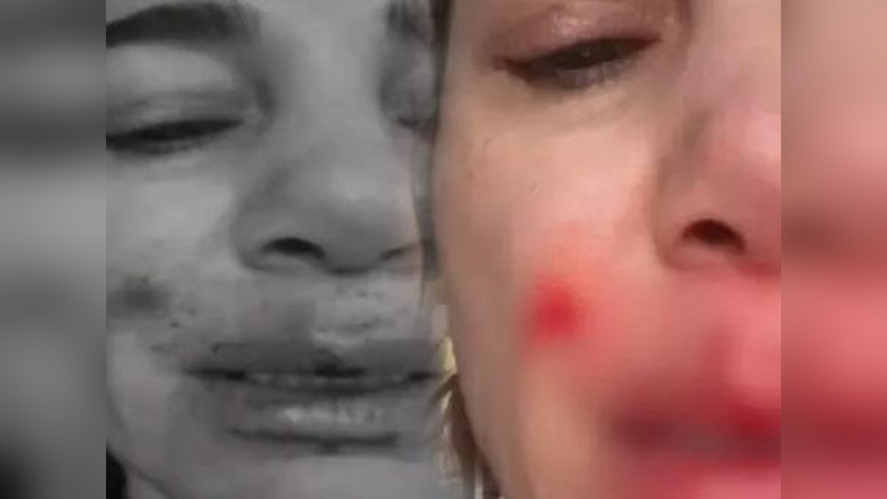Nadide Sultan Evinde Kaza Geçirdi