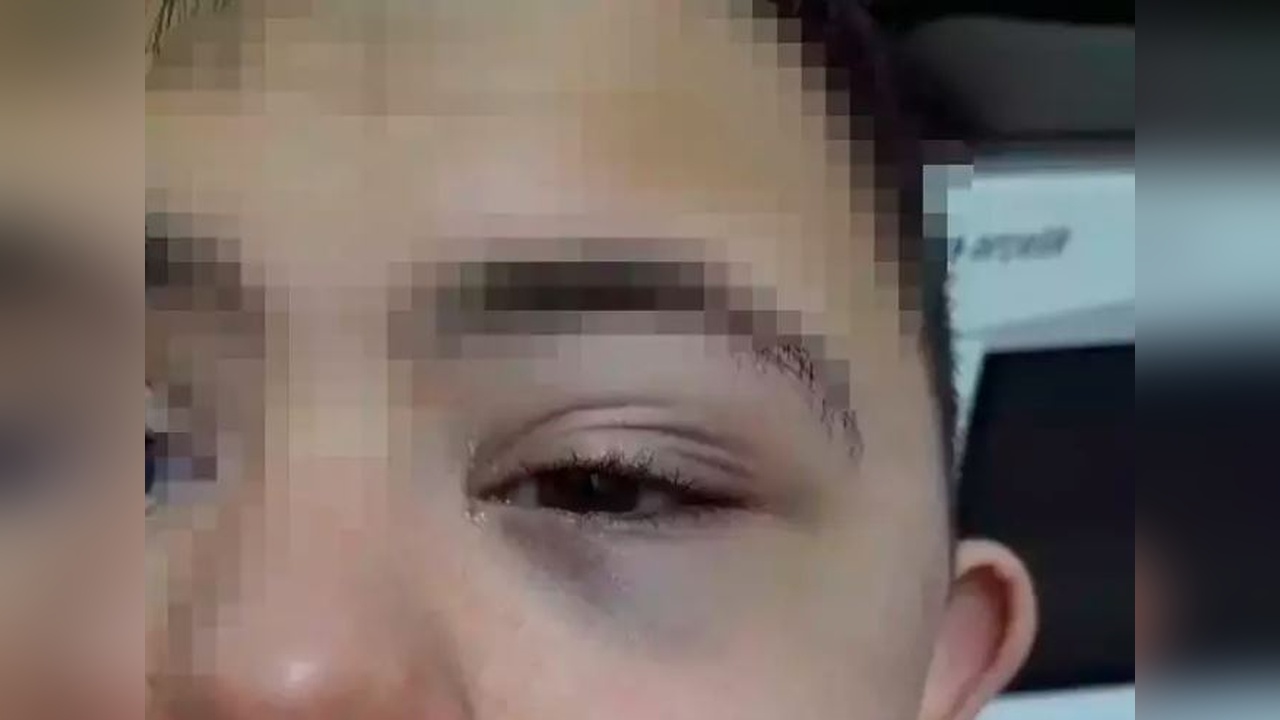 Öğretmene Down Sendromlu Öğrenciye Şiddetten Ceza Verildi