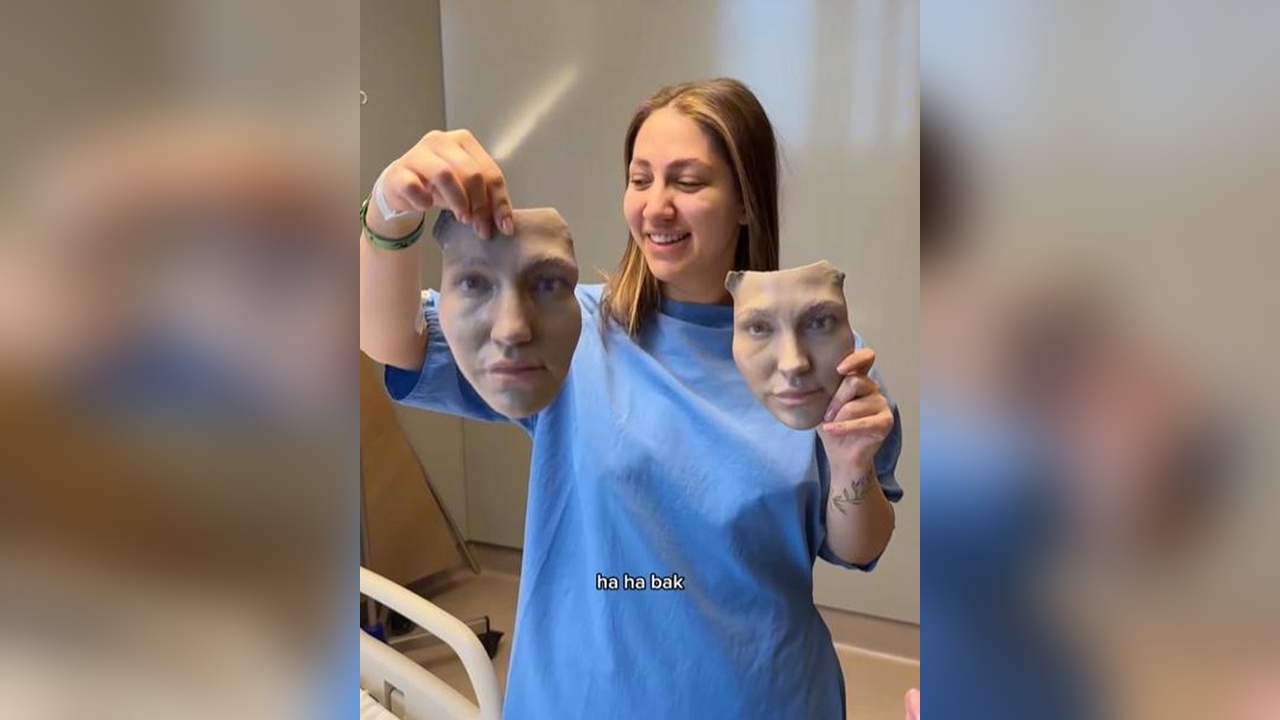 Damla Altun, Burun Ameliyatı Öncesi 3D Maske Yaptırdı