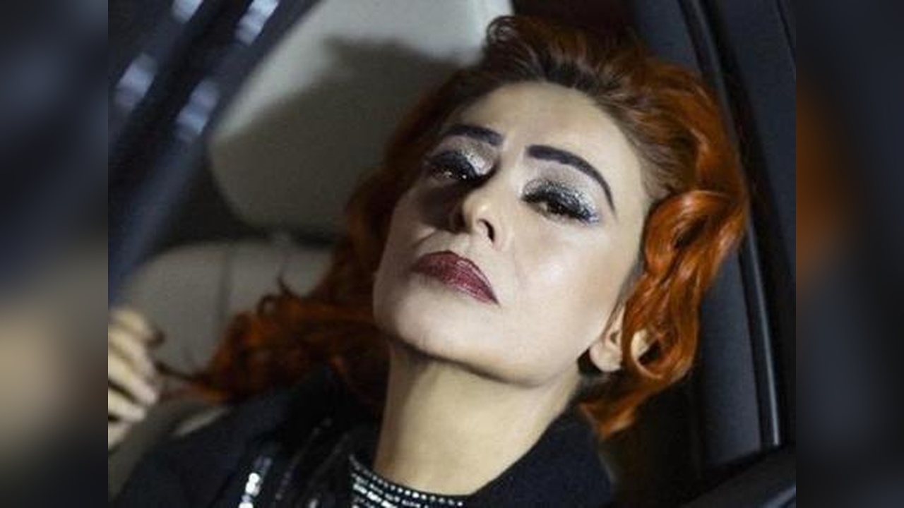 Yıldız Tilbe, Kimyasal Yanığın Ardından Son Halini Paylaştı