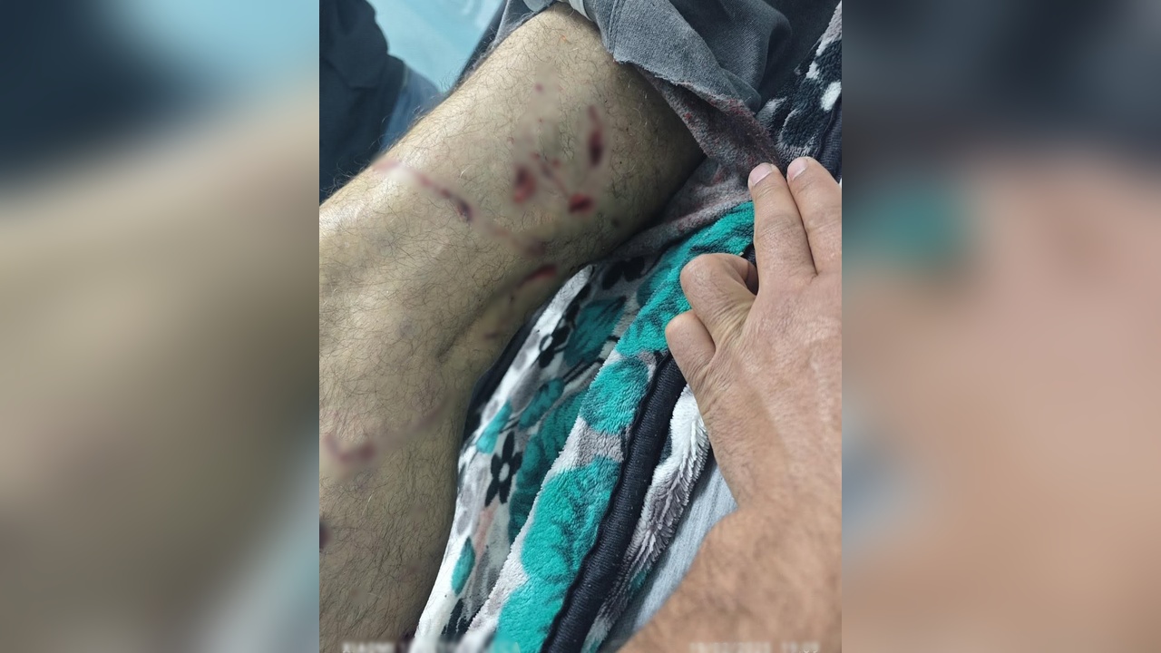 Sokak Köpeği Saldırısı: Bir Kişi Yaralandı