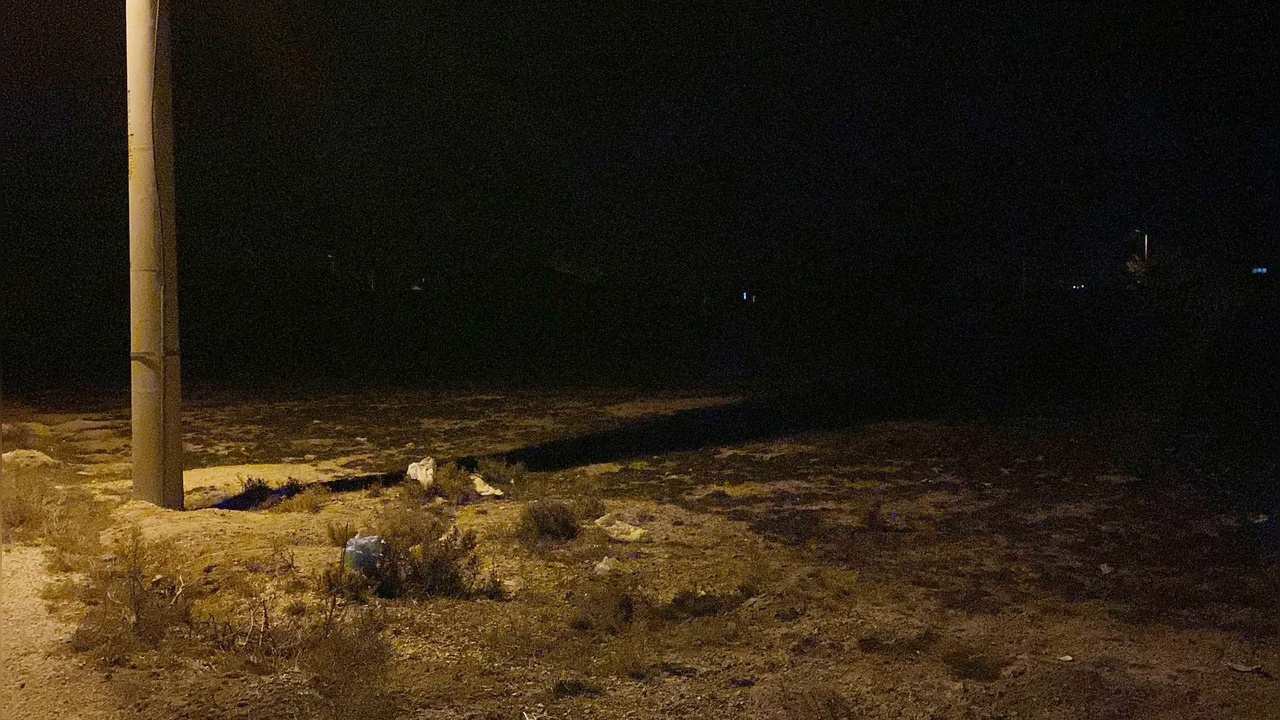 Sokak Köpekleri 2 Yaşındaki Kız Çocuğunu Hayatından Etti