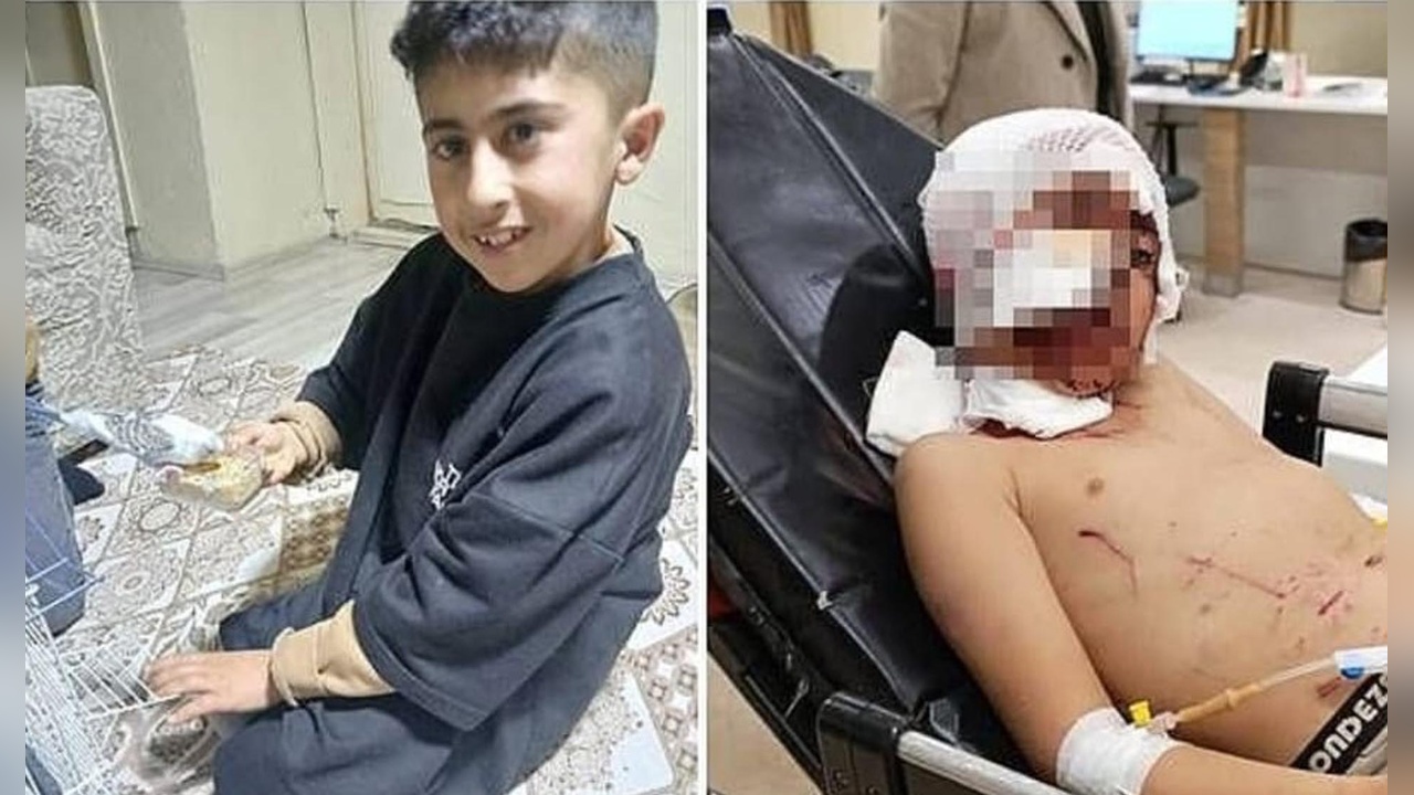 Köpek Saldırısı: Bakkala Giden Adam Ağır Yaralandı