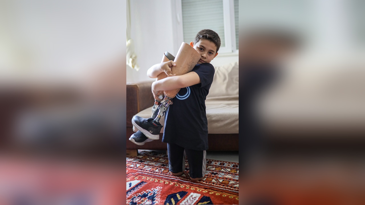 Aras'ın Protez Borcu Ödendi