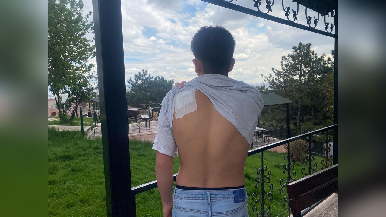 13 Yaşındaki Çocuğu Bıçaklayan Zanlının Serbest Kalması Tepki Çekti