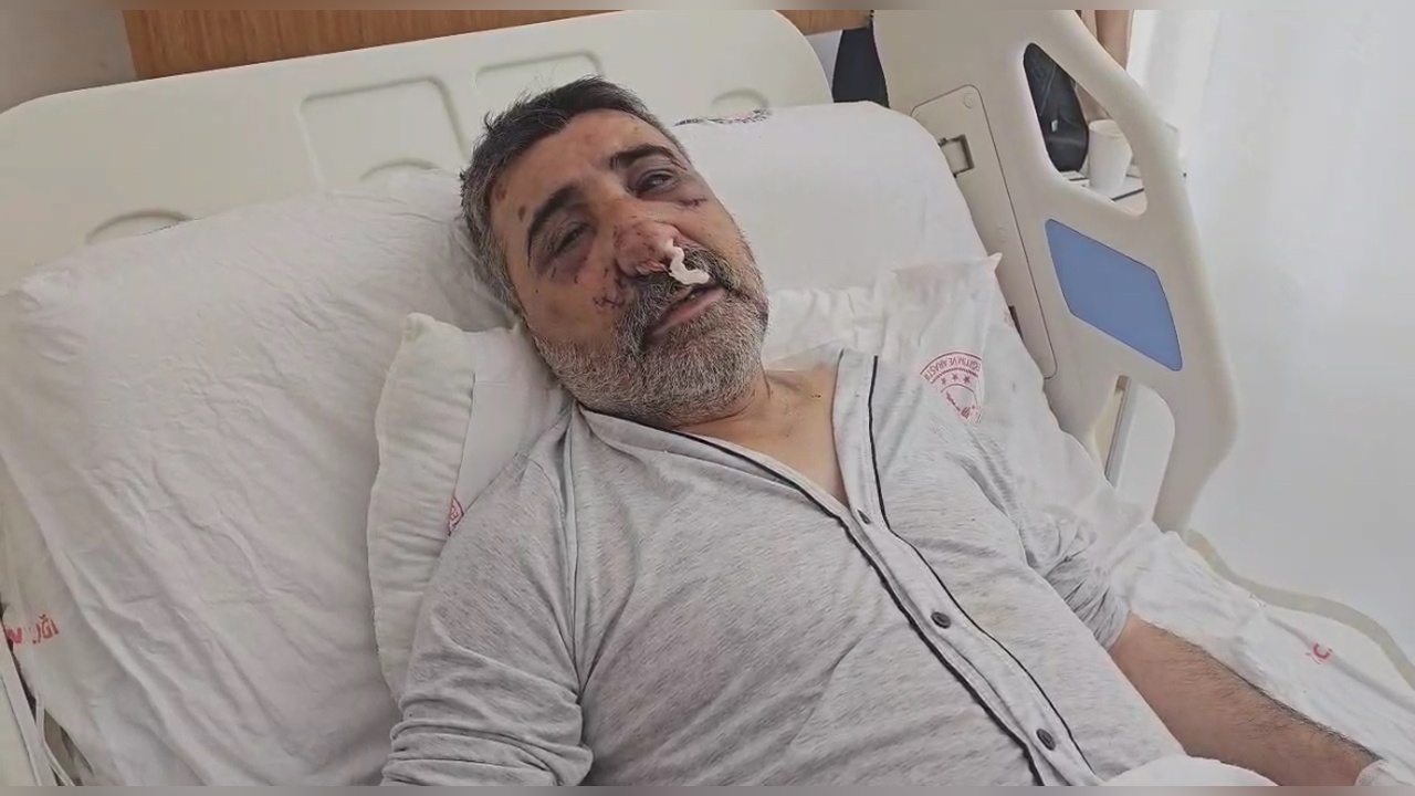 İngiliz Boksörün Saldırısına Uğrayan Taksici Olayı Anlattı