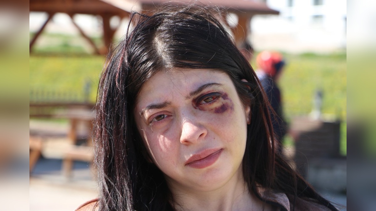 Samsun'da Sözlü Taciz ve Darp Olayında Tutuklama