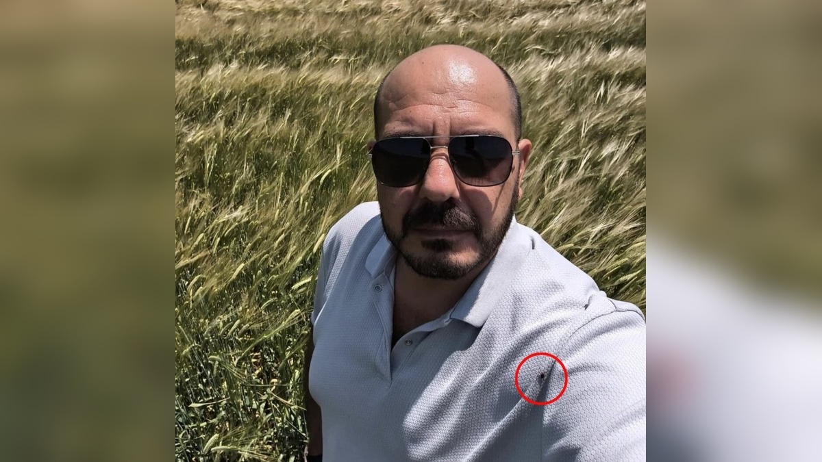 Amasya'da bayram ziyaretinde korkutan an: 20'den fazla kene
